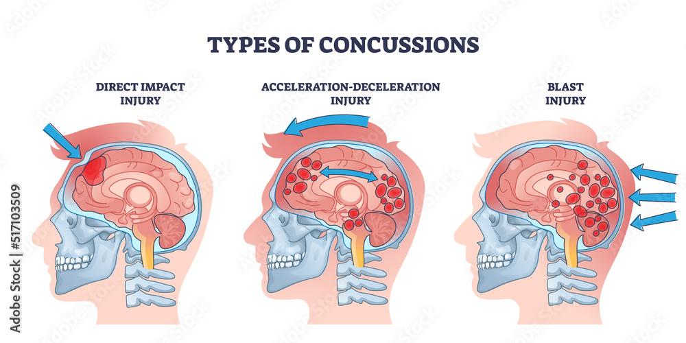 injury Impact:‌ How Player Availability Could⁤ Shift the Balance