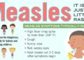 Measles Outbreak Alert: Russian Coach Sparks Health Crisis in Latvia!