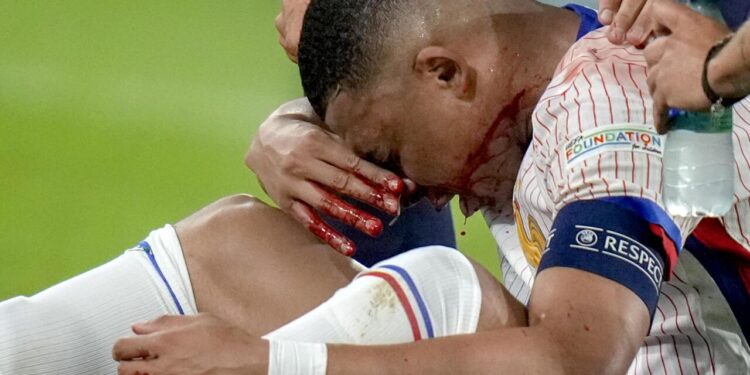 France Boss Confirms Kylian Mbappe Injury After Worrying Substitution – Sports Illustrated