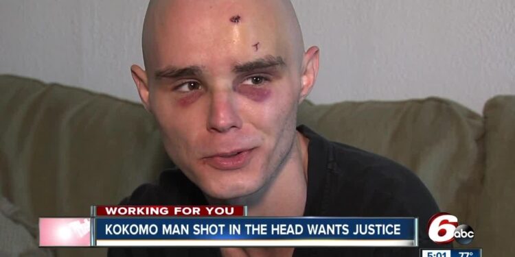 Man Is Shot and Tent Set on Fire Outside Serbia’s Parliament – The New York Times