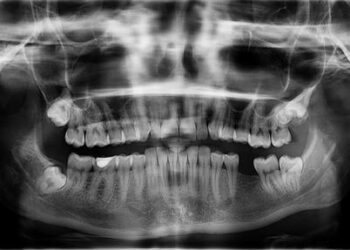 Why Rachael Ray Ditched The US For Italy – thelist.com