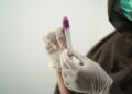 Samples taken but results not yet known – Bailiwick Express