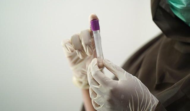 Samples taken but results not yet known – Bailiwick Express